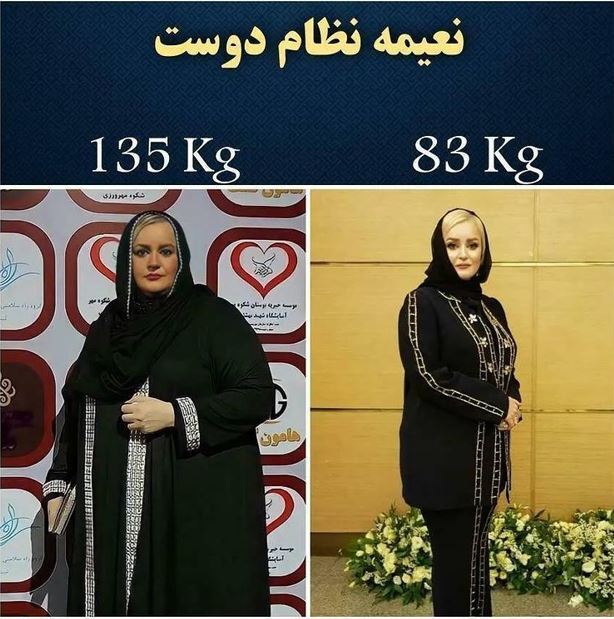 شوخی احسان علیخانی با چاقی نعیمه نظام دوست در جوکر / چرا بازیگر محبوب دوباره چاق شد؟ + عکس