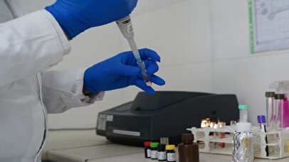 تشخیص آلزایمر و میزان پیشرفت آن با آزمایش خون