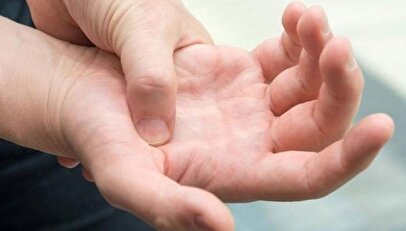 چه می شود که به سندرم تونل کارپال مبتلا می‌شویم؟ + روش درمان