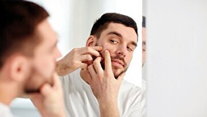 مهم‌ترین نکاتی که باید برای از بین بردن آکنه بدانید