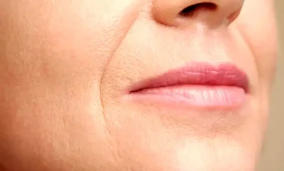 دلیل نازک شدن لب‌ها با بالا رفتن سن