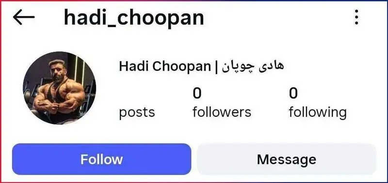 اینستاگرام هادی چوپان بسته شد