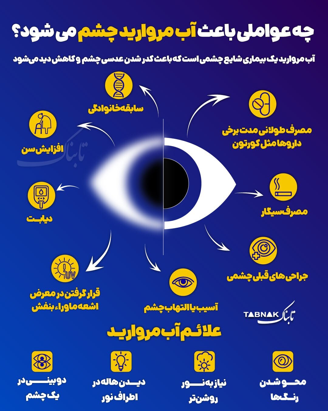 چه عواملی باعث آب مروارید می‌شود؟