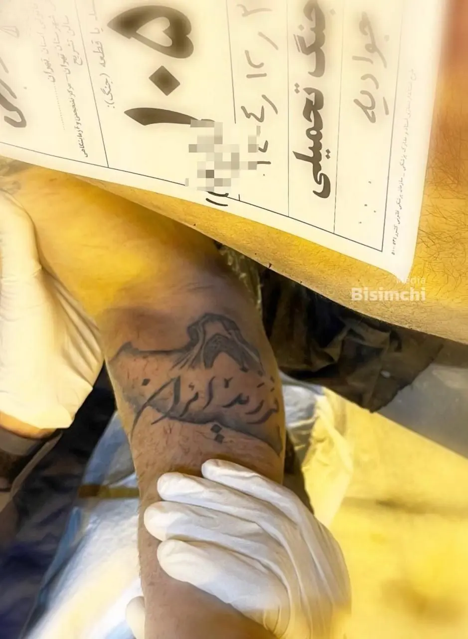 خالکوبی دردرناک یکی از شهدای جوادیه