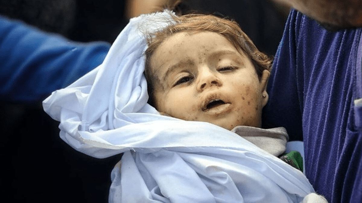 آخرین آمار از شهدا و مجروحان غیرنظامی تجاوز دشمن/ وزارت بهداشت اعلام کرد