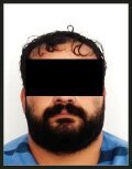 جنایت هولناک مرد یک‌پا با شلیک‌ کلاشینکف/ ۳ جوان در خون خود غلطیدند + عکس