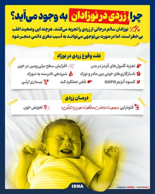 چرا زردی در نوزادان به وجود می‌آید؟/ اینفوگرافیک