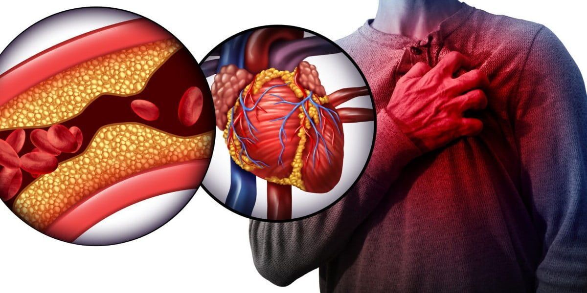 چند راهکار ساده خانگی برای کاهش کلسترول