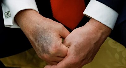 واکنش ونس به کبودی دست ترامپ/ اتفاقات وحشتناکی رخ داده است!
