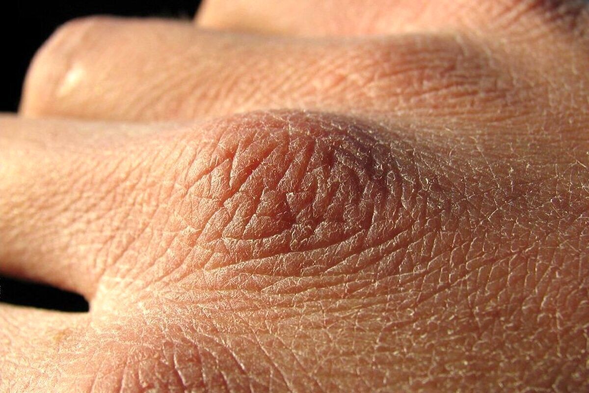 چرا بدن در پاییز تشنه‌تر است؟/ بهترین راهکار برای درمان کم آبی بدن چیست؟