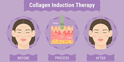 چگونه در سایت الانزا یک روتین مراقبتی کامل با بهترین قیمت انتخاب کنیم؟