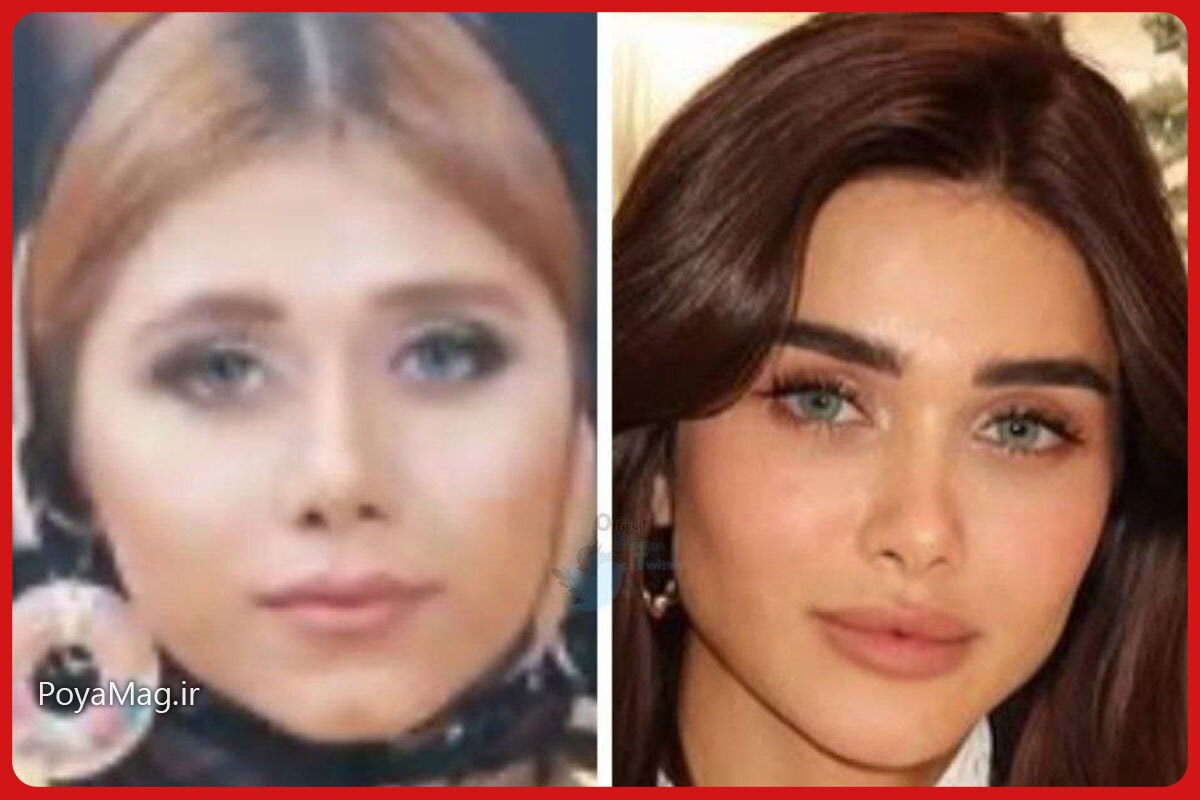 هیوا امین زیباترین زن خاورمیانه در سال ۲۰۲۵ شد/ عکس قبل و بعد از عمل زیبایی مدل ایرانی هیوا امین زیباترین زن خاورمیانه در سال ۲۰۲۵ شد/ عکس قبل و بعد از عمل زیبایی مدل ایرانی