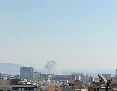 جزئیات مجروح شدن یک بازیگر در پی حمله آمریکا+ عکس