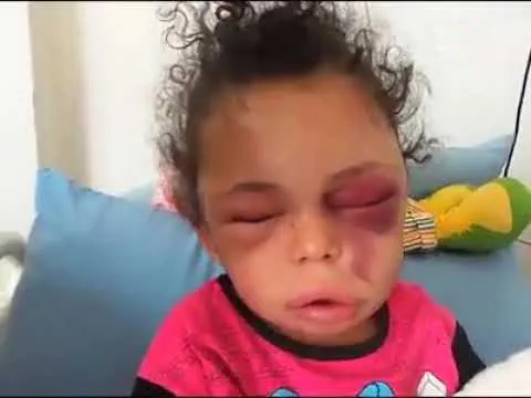عربستان دختری که عکسش دنیا را تکان داد ربود +عکس