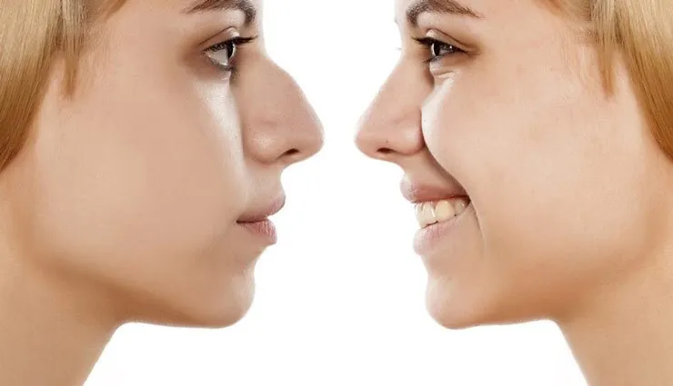 عوارض و خطرات بعد از عمل جراحی بینی