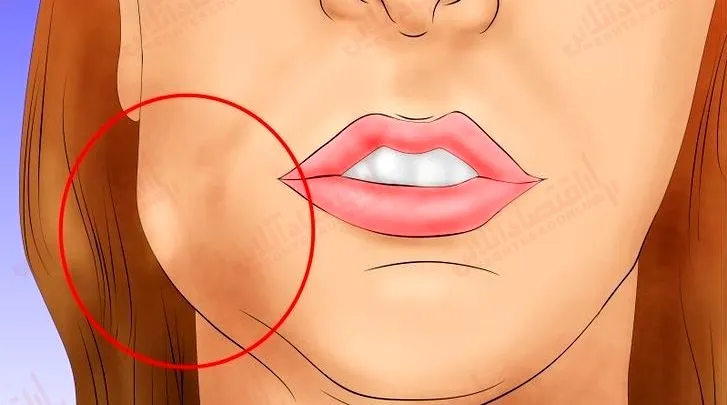 چگونه آبسه‌ ی دندان را درمان کنید؟