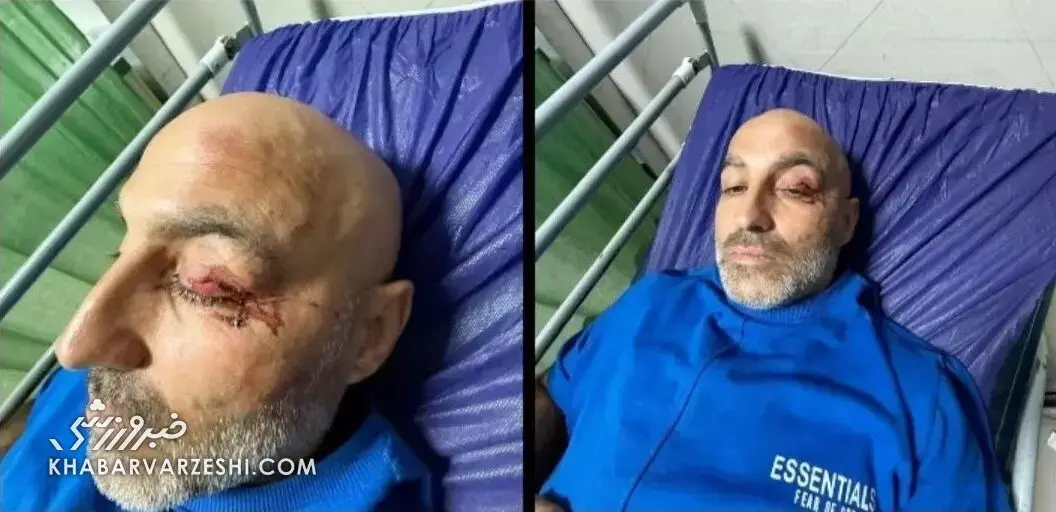 تصادف خطرناک چهره مشهور کشور / رامین محرم‌نژاد راهی بیمارستان شد