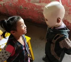 زندگی پسر بچه بدون چهره +عکس