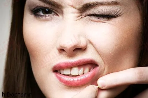 خانم هایی که هیچ وقت جوش نمی زنند چکار می کنند؟