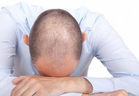 کچلی هم واگیردار است