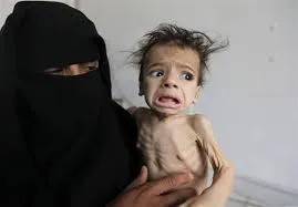 سازمان‌ملل: اوضاع انسانی در یمن به شدت بحرانی است