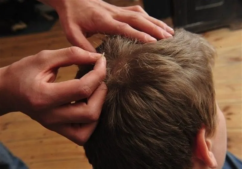 افزایش ۷ برابری شیوع شپش در مدارس!