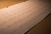 همه آنچه باید از سندرم مرگ ناگهانی بزرگسالان بدانید