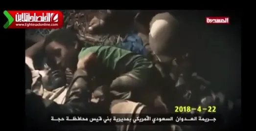 جدایی غم انگیز کودک یمنی از پیکر پدرش! +فیلم