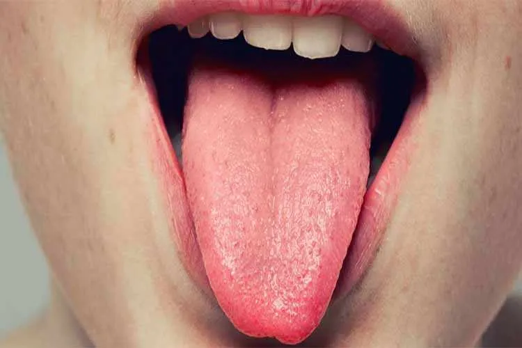 وقتی زبان مو درمی‌آورد!
