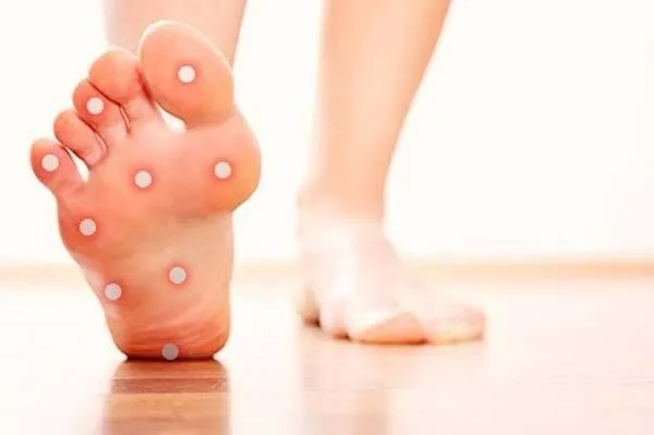 اولین علائم بیماری خار پاشنه چیست؟
