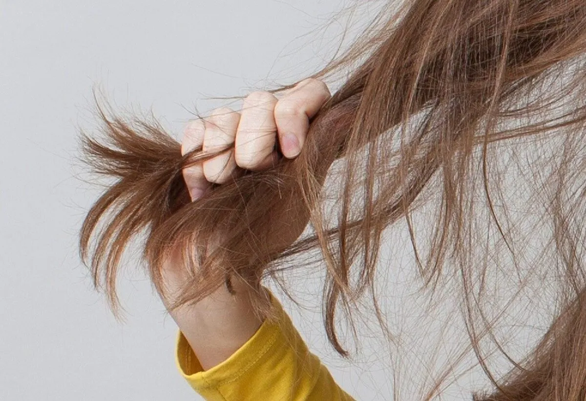 علت موخوره چیست؟ + بهترین درمان موخوره را بشناسید
