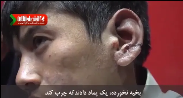 گفت و گو با کودک گوش بریده +فیلم