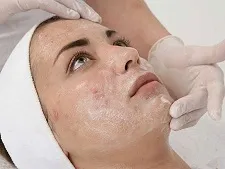 هر آنچه باید درباره لایه‌برداری پوست بدانید