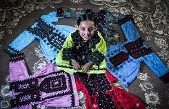 بیماری نادر «انیسه» +عکس