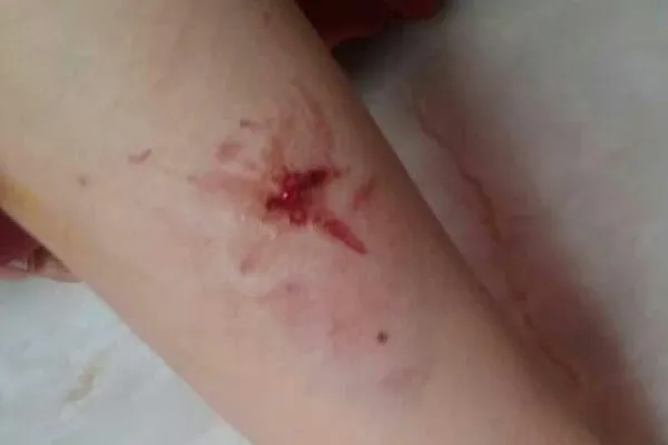 حمله سگ به یک خانم +عکس