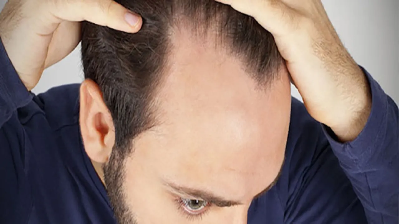 راهکارهای حل مشکلات رایج مو در زمستان