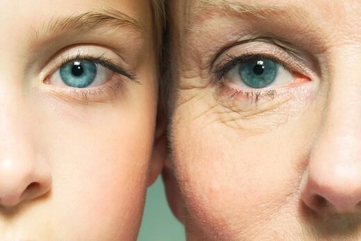 چرا زن ها زودتر از مردا پیر می شن؟