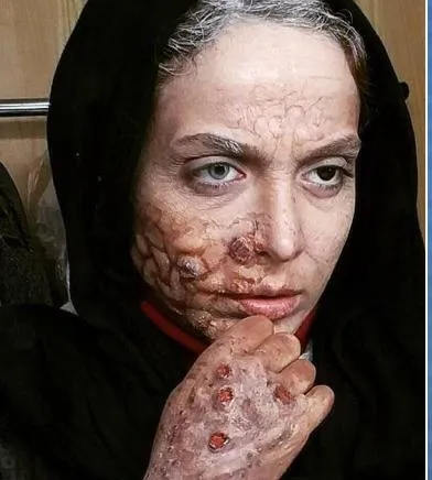 سوپر استار زن مشهور ایرانی با گریم زامبی +عکس