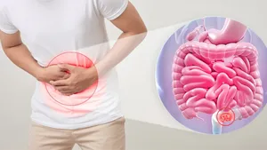 دلیل یبوست مزمن را بشناسید