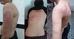 معلم سنندجی به دادسرا احضار شد/ معاینه پزشکی تمامی دانش آموزان مصدوم 