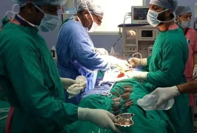 ۴۰ چاقو در معده بیمار!