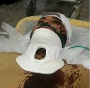 ضرب و شتم روحانی کرجی توسط ۹نفر +عکس