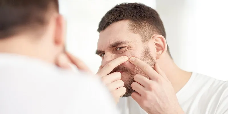 5‌غذا برای دفاع از پوست در مقابل آکنه
