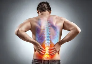 قبل از جراحی دیسک کمر، این نکته مهم را بدانید / MRI به‌تنهایی حکم جراحی نمی‌دهد