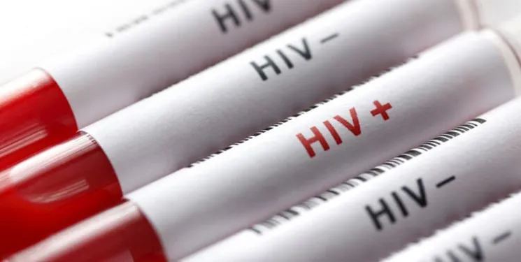 داروهای بیماران HIV در کشور تولید می شود