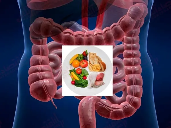 برنامه رژیم غذایی کولیت اولسراتیو تهیه کنید