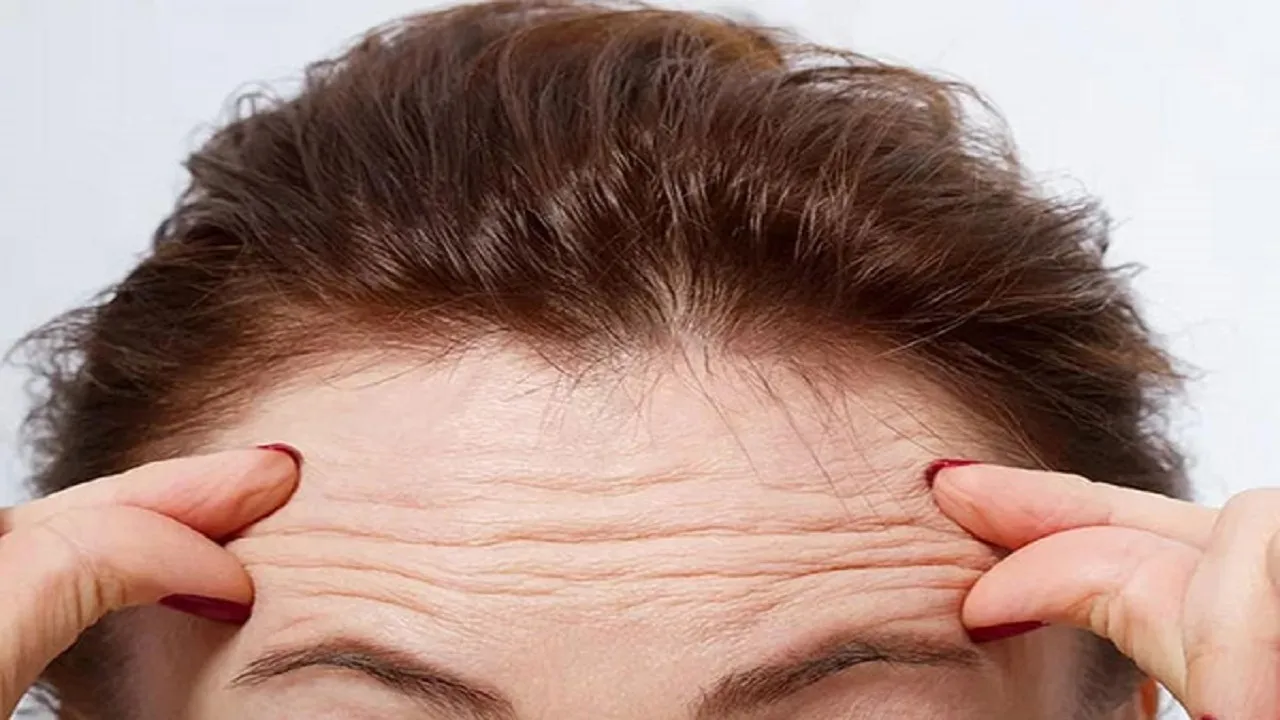 ارتباط چروک پوست پیشانی و گروهی از بیماری‌ ها