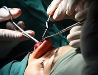 تصاویری وحشتناک از جراحی بینی