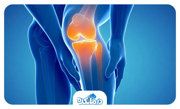 آرتروز یا Osteoarthritis چیست؟