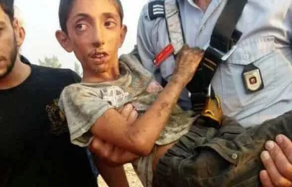 مادر خشمگین پسرش را به چاه انداخت